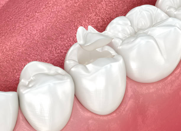 Best Wisdom Tooth Removal  in Lincoln, NE